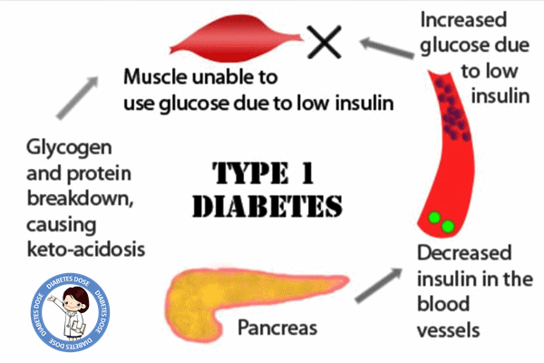 type 2 diabetes symptoms