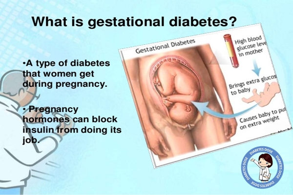 What is Gestational Diabetes during Pregnancy, Causes, Symptoms, Diet, Test, Prevention